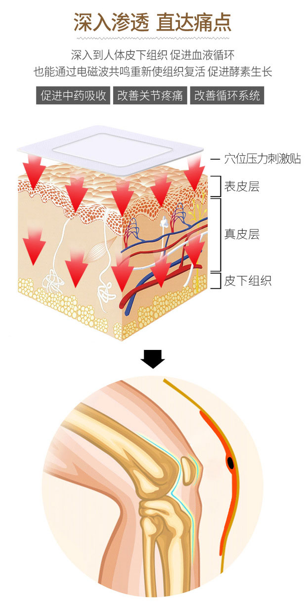 穴位壓力刺激貼膏藥深入滲透直達(dá)痛點(diǎn)